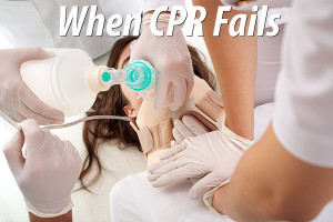 When CPR Fails
