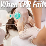 When CPR Fails